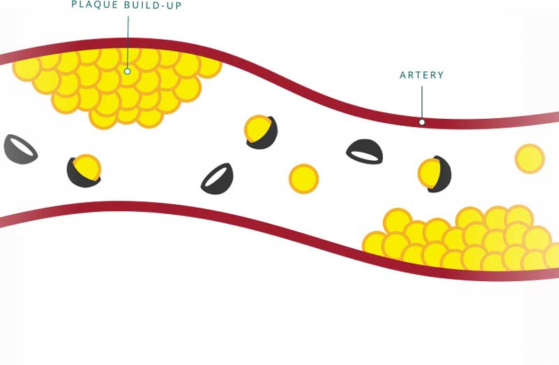 imbieras ir cholesterolis